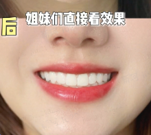 飞书文档 - 图片 (2).png